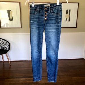 Madewell button-front skinny jeans